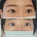 쌍둥이안경.콘텍트 | 경산사동 컬러렌즈 쌍둥이안경 위드렌즈 경산사동점 뉴트럴무드