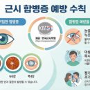 바른아이안경, 콘택트 네이버블로그