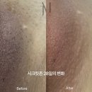 미랩 | 부산 미랩 멜라닌케어는 주니엠뷰티 임상후기다량보유👍