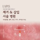 강남라이프산부인과의원 | 강남 미레나 카일리나 제이디스 제거 &amp; 삽입 시술 병원 - 부정출혈, 생리, 임신, 후기, 부작용 FAQ