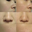 임프레스 이미지