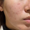 고봉민김밥인 고덕에듀타운점 | [평택에스테틱] 오픈 이벤트 가성비 좋은 평택고덕피부관리 '더맑은스킨 평택에듀타운점'