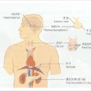 산삼약침의 효능- 암치료에 효과 있다. 이미지