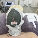 미플러스 에스테틱 | 인천 학익동 피부관리 , 에스테틱 “미플러스에스테틱”에서 MTS 관리 받은 후기