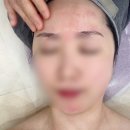 보누스킨