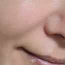 유알픽