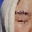 아이이뽀 | [경기/안산] 아이이뽀&테오트리안산 후기_안산피부관리