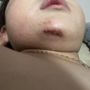 박종필성형외과 이미지