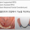 김희중치과 네이버블로그