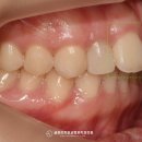 글로리치과교정과치과의원 이미지