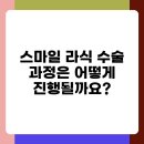 스마일 라식 시력 교정 수술 과정과 후기 요약