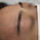 펫미인 | 장유눈썹문신 붉은 눈썹 잔흔 제거 이안브로우 만족 후기