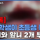 [단독] 남자 중학생이 여자 초등생 폭행..."코뼈와 앞니 부러지고 정신과 치료" 이미지