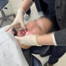 다온치과기공소 | 대구 닥터손치과 직접 체험한 치아미백 후기 1주차