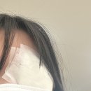 잘보는서울안과의원 | 눈 점막 점 속눈썹점 제거 서울 안과 내돈내산 보험 실비 병원 비용