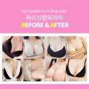 김지연위쉬성형외과의원 네이버블로그