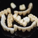 다이아몬드치과기공소 이미지