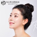 리스펙성형외과의원 네이버블로그