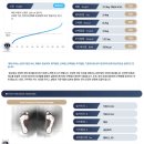 영하슈퍼 | 아이 키성장 슈퍼키즈성장센터 내돈내산 후기