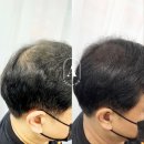 일산두피&눈썹단미토탈뷰티