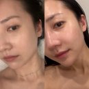 강남 신논현 속건조케어 리엔에스테틱 물광테리피 후기