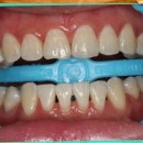 청담미소밝은치과의원 이미지