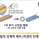 녹내장 진행에 맞춰 안압 조절 가능한 치료 튜브 개발 이미지