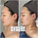 연스테틱 | [전주/인후동] 예민한 피부 원장님 오마카세 관리 '피엘르X리겐스킨랩 인후점' 후기