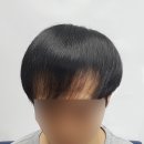 김현일미용실 | 나에게 맞는 증모술을 선택하는 방법을 알려드립니다