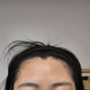 용산-303 | [용산 왁싱] 없는 라인도 만들어주는 '새봄' 헤어라인 왁싱 찐 후기 (3자/M자 이마 극복!)