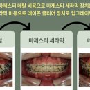 투명한이치과교정과치과의원 네이버블로그