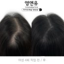 영앤유