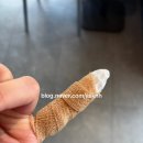 매듭병원 | [수원 정형외과 추천] 매듭병원 망포 진료후기