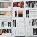 [척추측만증 교정-독일식 슈로스 운동(Schroth Method) 전문가 과정 Basic Course] - 2026년 8월 30일(일) 이미지