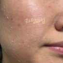율한의원 - 성남시 분당구 대왕판교로 660 | 천안 불당동 피부과 한의원 율각테라피 후기 모공치료
