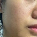 알프스마트 | ✨ 맑은 피부 자신감! 알프리쉬 앰플로 잡티 고민 싹~ 순한 헬리크리섬앰플 후기!