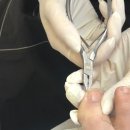 고덕메디칼약국 | [푸스케어 평택고덕점] 평택 내성발톱, 무좀 등 문제성 발케어관리 전문샵