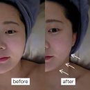 전영미헤어 | 둔산동 에스테틱 대전 윤곽관리 미플 리프팅 얼굴라인정리