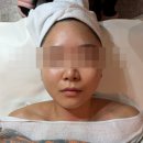 신봉브이샤르망3 | 미금역 피부관리 루오나에스테틱 윤곽관리 / 피부관리 솔직한 후기