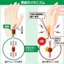 스마트폰 조작으로 발증도…「건초염」예방하려면？ 이미지