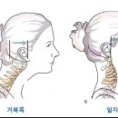 근육풀이 네이버블로그