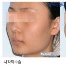 디오메디 이미지