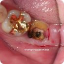 삼성플란트치과의원 이미지