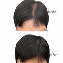 자연에서 얻은 참다운 삶 | 전주두피문신 후기 자연스러움이 삶을 바꾼 순간