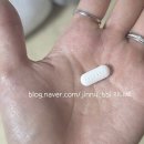단단플란트치과의원 네이버블로그
