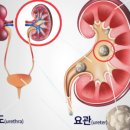 라임비뇨의학과의원 네이버블로그