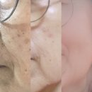 엄마와 함께 에버콜라겐으로 부작용 없이 관리하는 이너뷰티 12주차 후기 (#인앤업플러스 &amp; #코큐)
