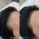 이은영헤어 - 강릉시 | 서산 헤어라인문신 잘하는곳ㅣ은요뷰티 후기&가격 공개