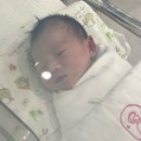 골든베베 | 신생아 귀접힘 셀프교정. 뾰족귀,엘프귀 변화 후기 (100일후 모습) 쿠팡 베베이어 후기