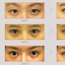 에스원성형외과의원 이미지